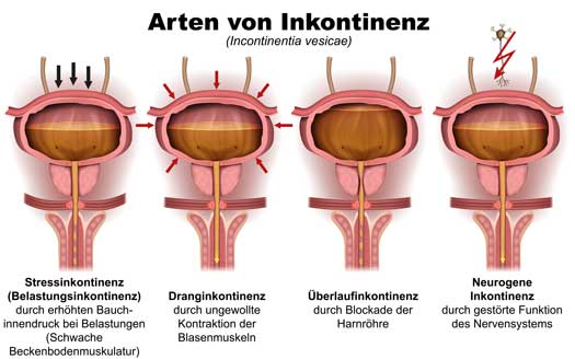 Inkontinenz Praxis Dr. Maßling